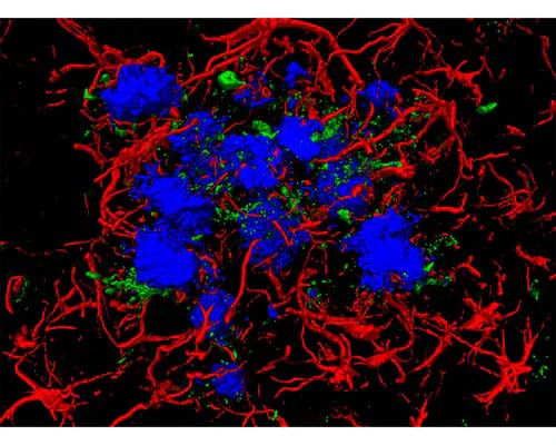 Amylo-Glo® Amyloid Plaque Stain - Image 3