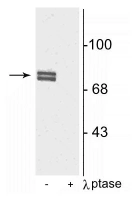 Anti-5-Lipoxygenase (Ser523) Antibody