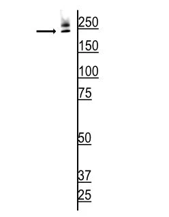 Anti-ABCA4 (Rim Protein) Antibody - Image 2