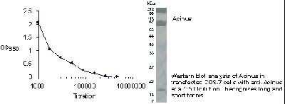 Anti-Acinus Antibody
