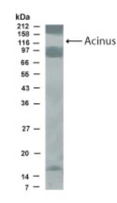 Anti-Acinus Antibody