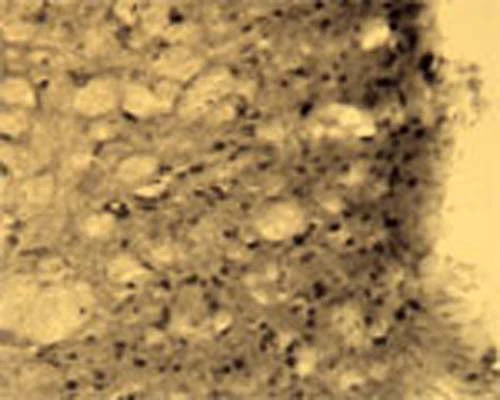 Anti-Activity-regulated cytoskeleton-associated protein (Arg3.1) Antibody