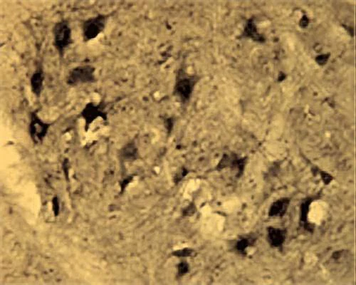 Anti-Activity-regulated cytoskeleton-associated protein (Arg3.1) Antibody - Image 2