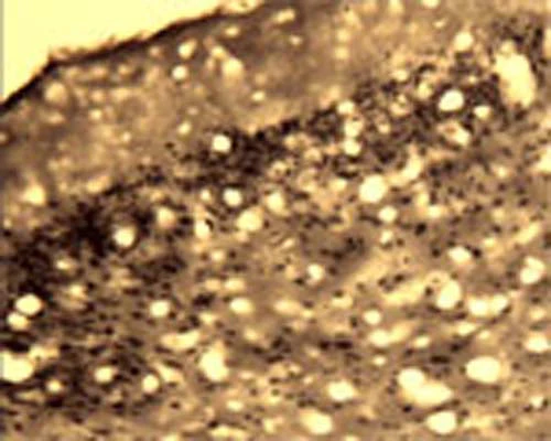 Anti-Activity-regulated gene 3.1 protein homolog (Arg3.1) Antibody
