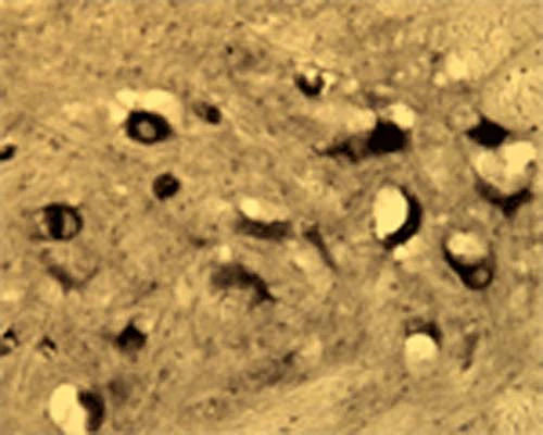Anti-Activity-regulated gene 3.1 protein homolog (Arg3.1) Antibody - Image 4