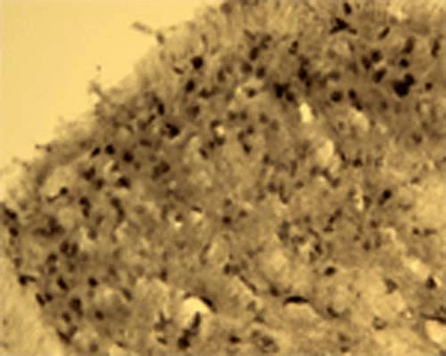 Anti-Activity-regulated gene 3.1 protein homolog (Arg3.1) Antibody - Image 5