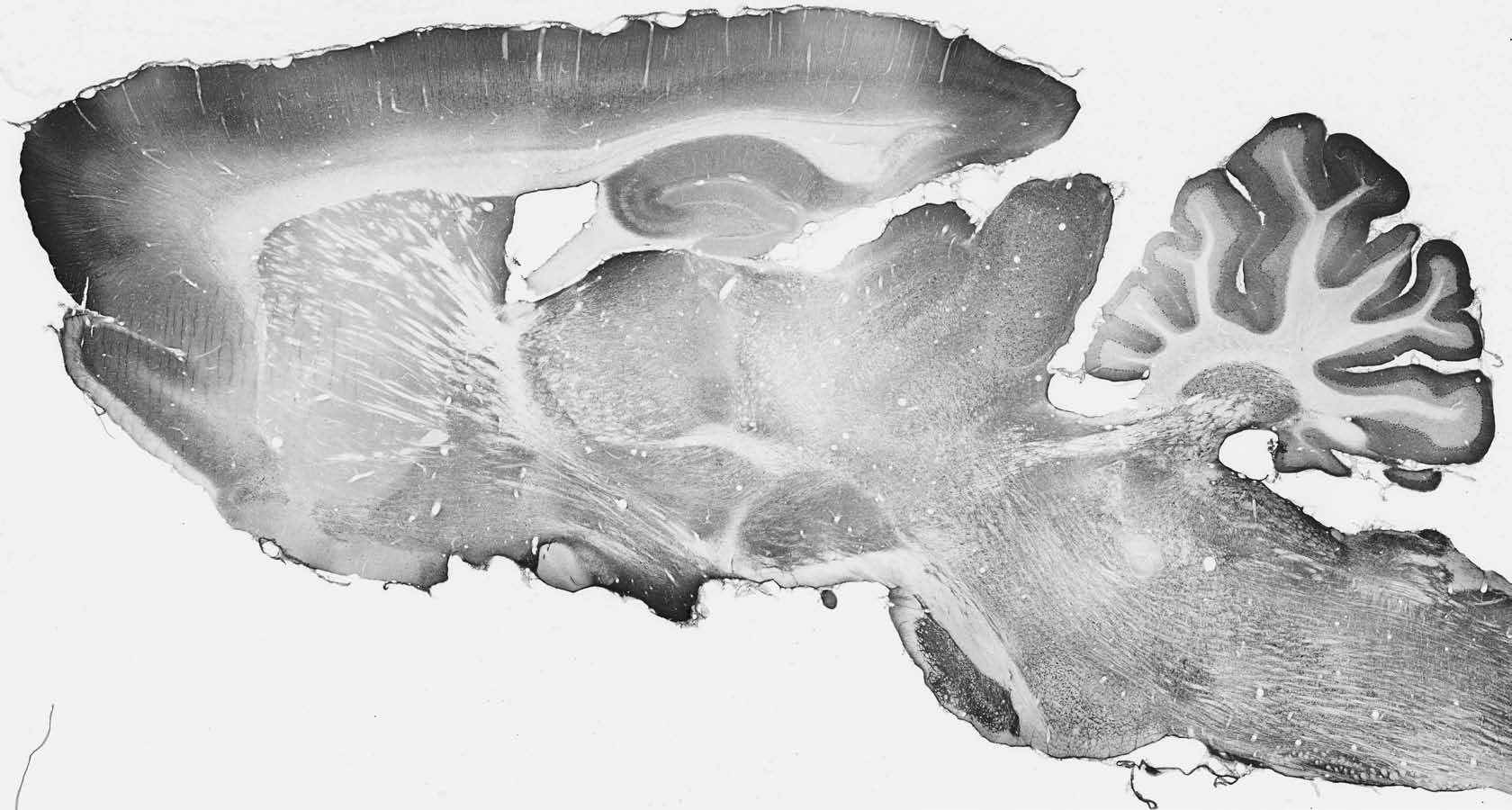 Anti-ADAM11 Antibody