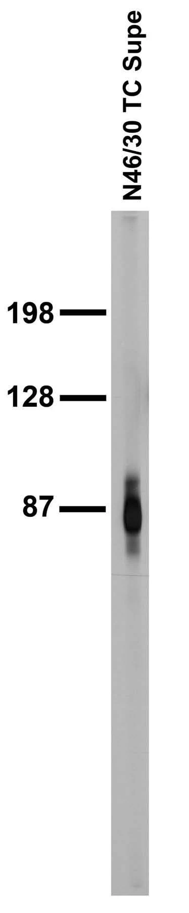 Anti-ADAM22 (Cytoplasmic) Antibody - Image 2