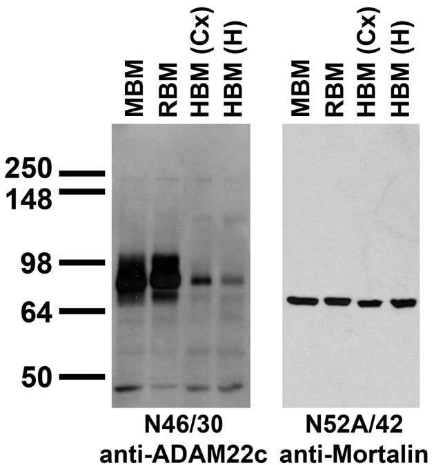 Anti-ADAM22 (Cytoplasmic) Antibody - Image 5