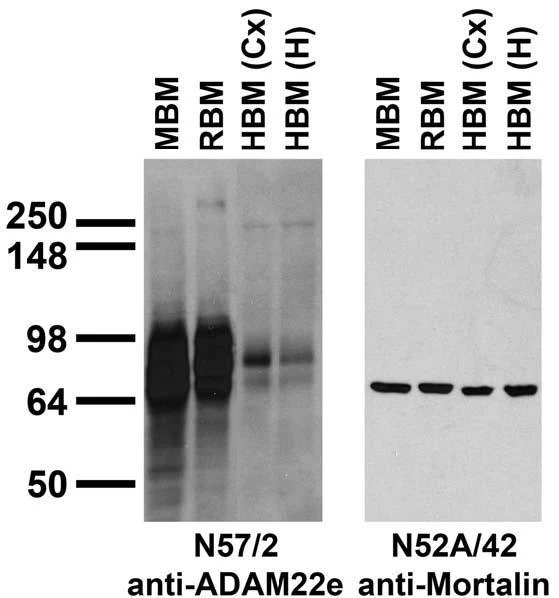 Anti-ADAM22 (Extracellular) Antibody - Image 3