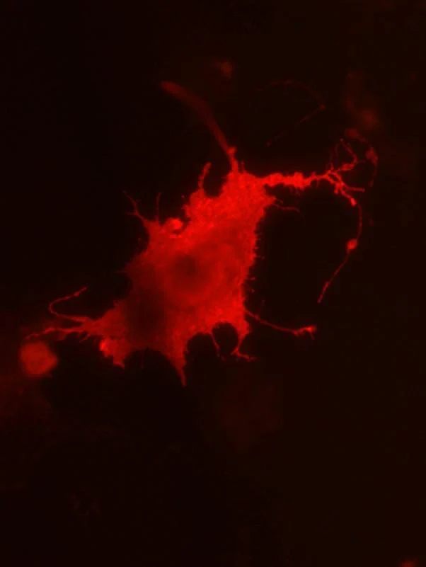 Anti-ADAM22 (Extracellular) Antibody - Image 4