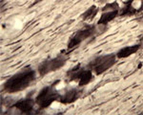 Anti-Adenosine triphosphate (ATP)- ase (ATPase) Antibody