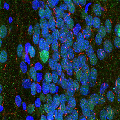 Anti-Adenylate Cyclase III Antibody