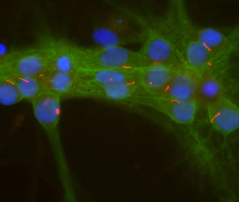 Anti-Adenylate Cyclase III Antibody - Image 2