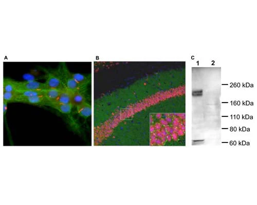 Anti-Adenylate cyclase type III (ACIII) Antibody