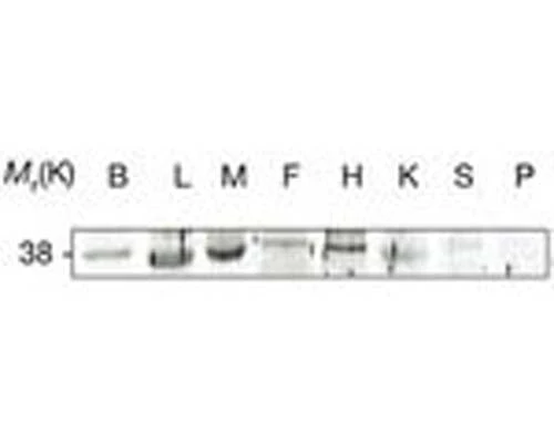 Anti-Adiponectin Receptor 1 (AdipoR1) Antibody
