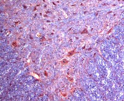 Anti-Adrenergic Receptor Alpha 2c Antibody