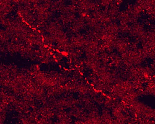 Anti-Adrenocorticotropic hormone (ACTH) Antibody