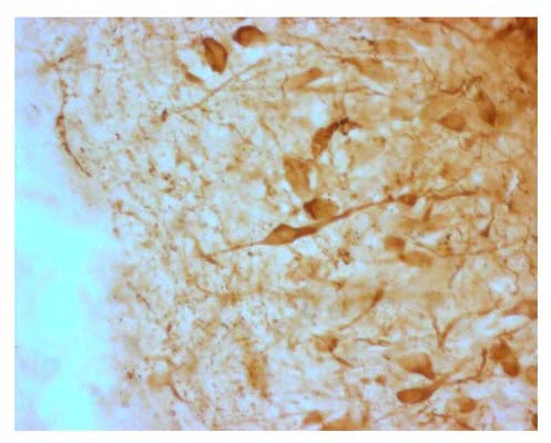 Anti-Agouti related protein (AGRP) Antibody