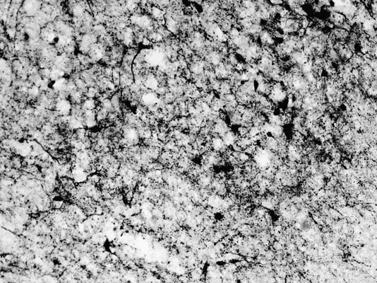 Anti-Agouti related protein (AGRP) Antibody - Image 3