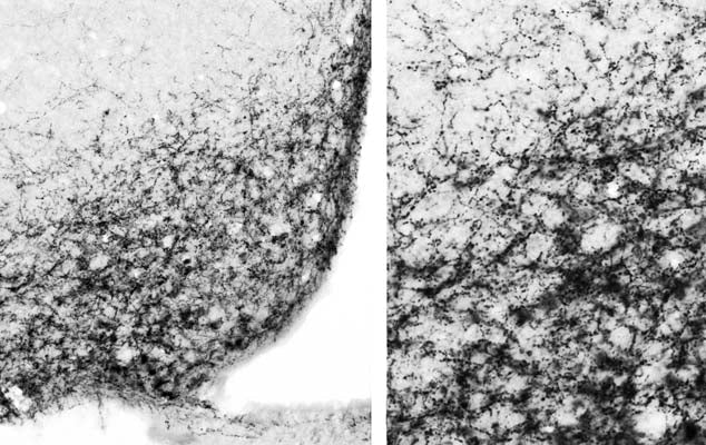 Anti-Agouti related protein (AGRP) Antibody - Image 4