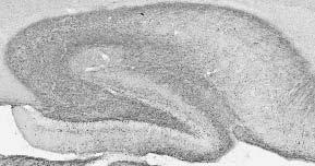 Anti-AGPS Neo-Epitope Antibody
