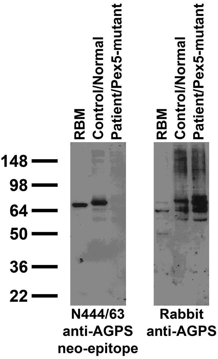 Anti-AGPS Neo-Epitope Antibody - Image 2