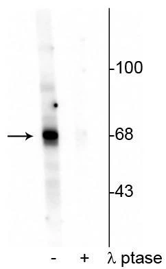 Anti-AKT (Thr342) Antibody