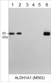 Anti-ALDH1A1 (N-terminal region) Antibody