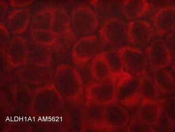 Anti-ALDH1A1 (N-terminal region) Antibody - Image 2