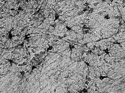 Anti-Aldh1L1 (Staining) Antibody
