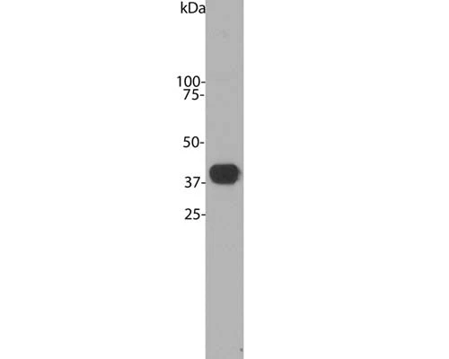 Anti-Aldolase C Antibody