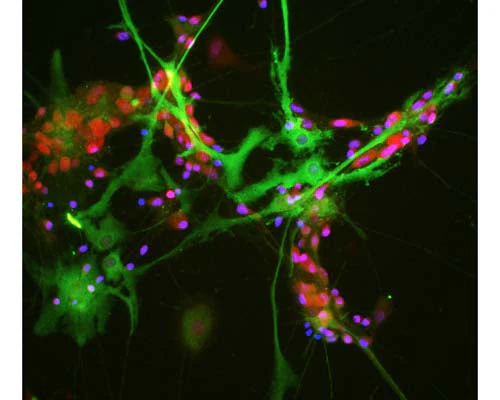 Anti-Aldolase C Antibody - Image 2