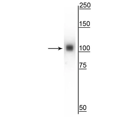 Anti-Alpha Actinin 4 Antibody