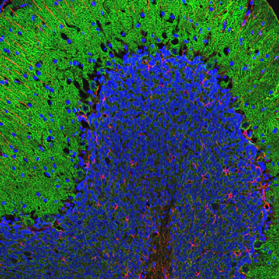 Anti-Alpha II Spectrin Antibody