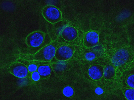 Anti-Alpha II Spectrin Antibody - Image 3