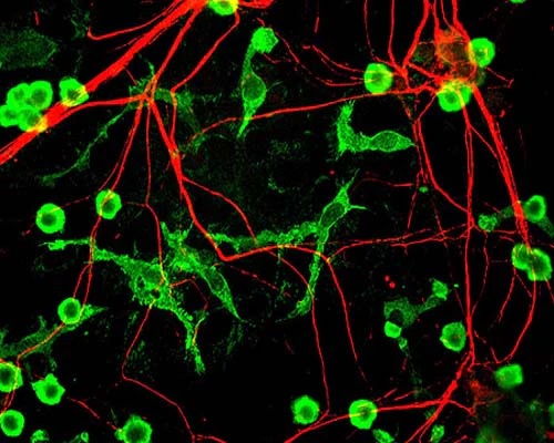 Anti-Alpha-internexin (Alpha-Inx) Antibody