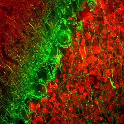Anti-Alpha Internexin/ NF-66 Antibody