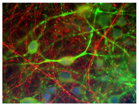 Anti-Alpha Internexin/ NF-66 Antibody - Image 2