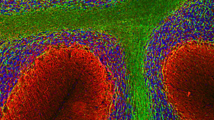 Anti-Alpha Internexin/ NF-66 Antibody