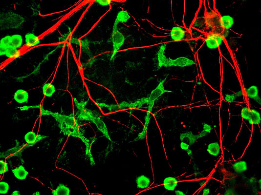 Anti-Alpha Internexin/ NF-66 Antibody - Image 2