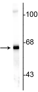 Anti-Alpha Internexin/ NF-66 Antibody - Image 3