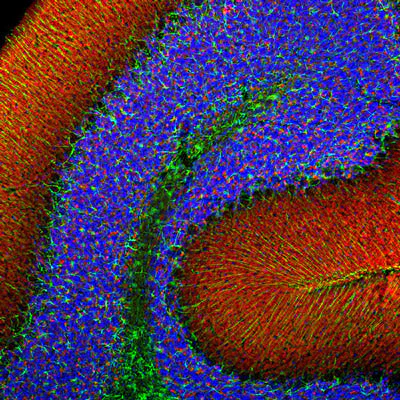 Anti-Alpha Synuclein Antibody - Image 2