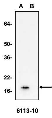 Anti-Alpha Synuclein Antibody - Image 3