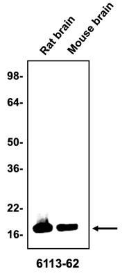 Anti-Alpha Synuclein Antibody - Image 2
