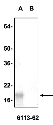 Anti-Alpha Synuclein Antibody - Image 3