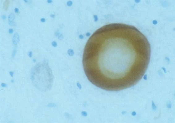Anti-Alpha-synuclein Antibody - Image 3