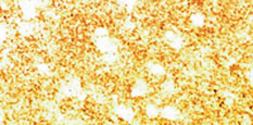 Anti-Alpha-synuclein Antibody