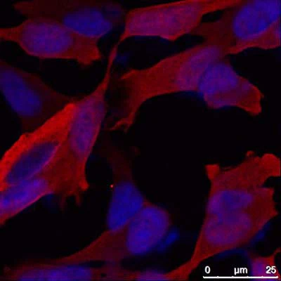 Anti-Alpha-synuclein Antibody - Image 2