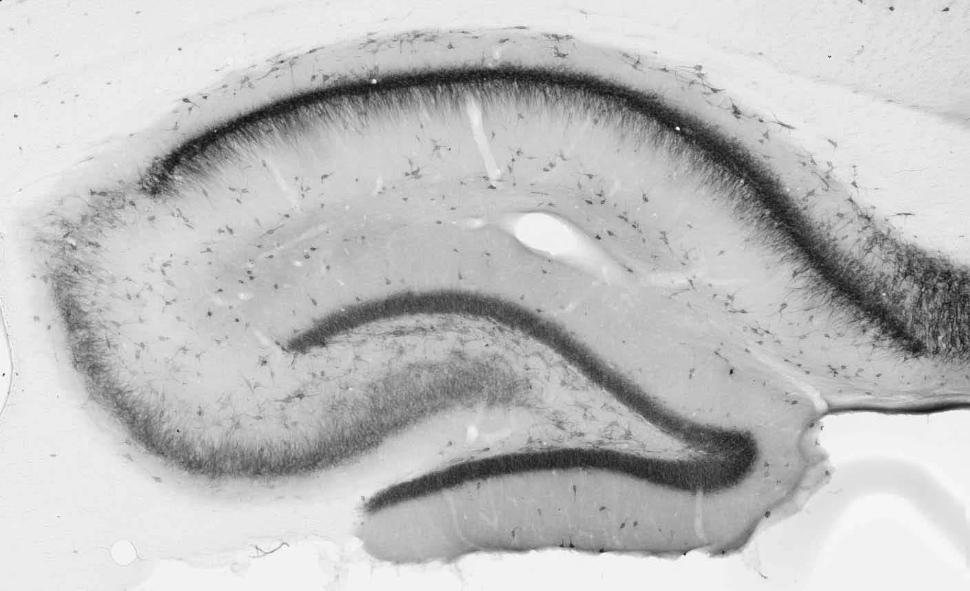Anti-AMIGO-1 Antibody - Image 2
